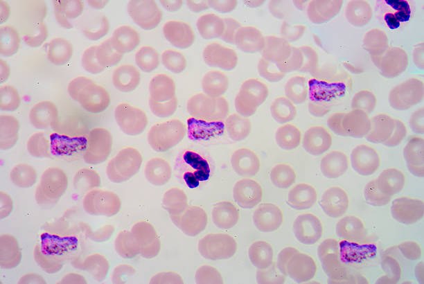 istock blood films for Malaria parasite. 474138736