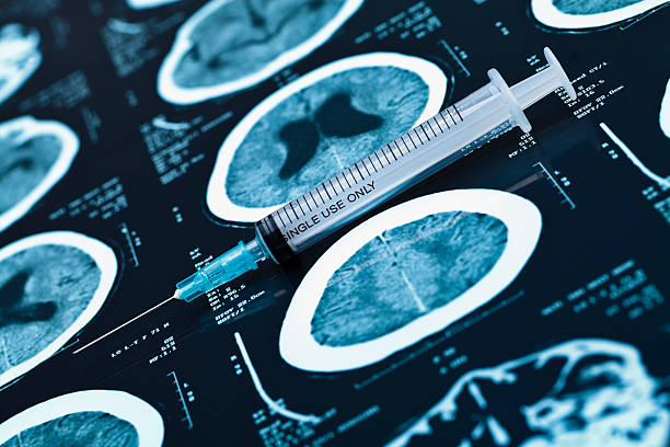 cabeça de raios-x e seringas. - brain mri scan alzheimers disease medical scan imagens e fotografias de stock