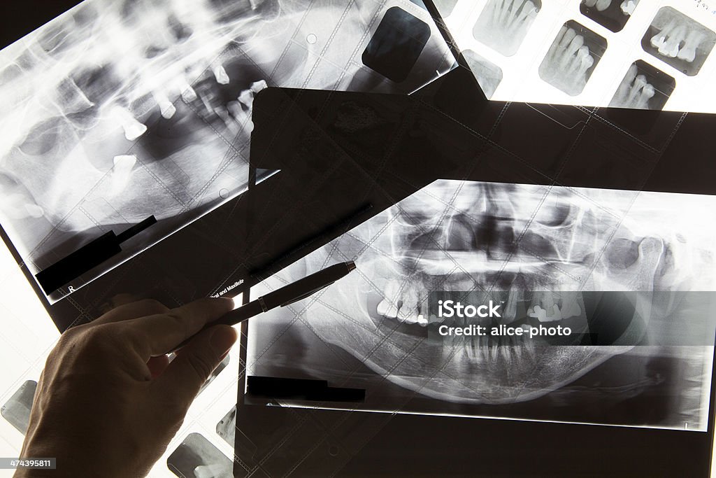 Panoramic dental X-Ray film for dentist Canon EOS5d mark2, lens 24-70 L, London 2014 Anatomy Stock Photo