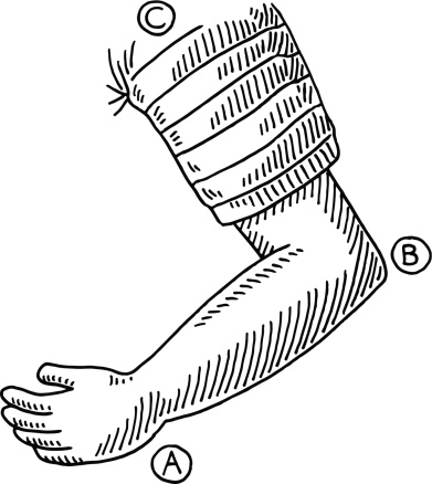 Hand-drawn vector drawing of a Child's Arm Bent at Elbow. Black-and-White sketch on a transparent background (.eps-file). Included files are EPS (v10) and Hi-Res JPG.