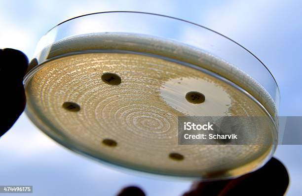 Esbl 大腸菌 - シャーレのストックフォトや画像を多数ご用意 - シャーレ, バクテリア, ヘルスケアと医療