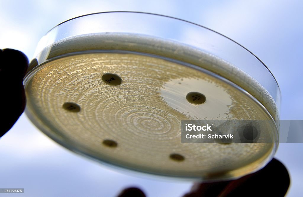 ESBL E. coli - Стоковые фото Агар роялти-фри