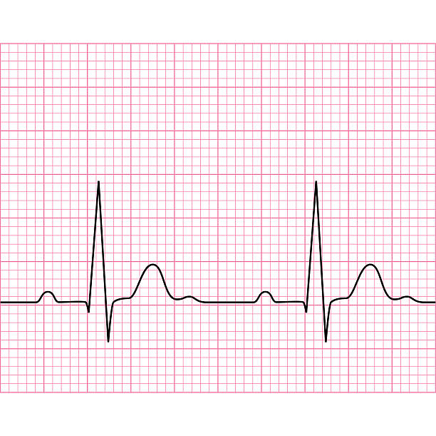 Illustration of medical electrocardiogram - ECG on chart paper vector art illustration
