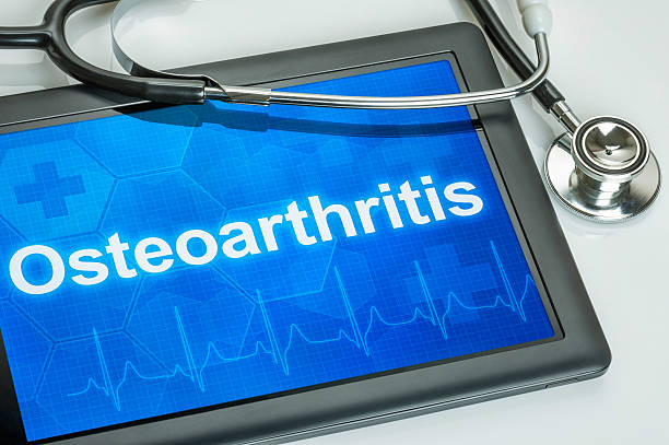 istock Tablet with the diagnosis Osteoarthritis on the display 474849268