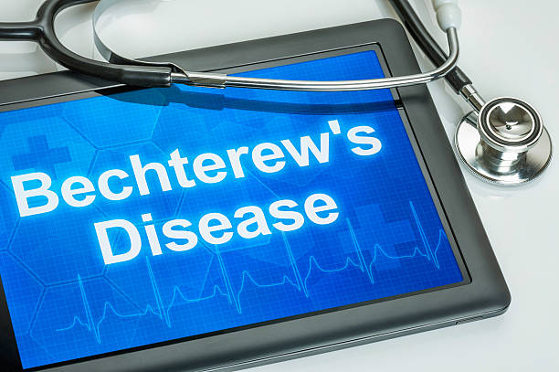 istock Tablet with the diagnosis Bechterews Disease on the display 474852868