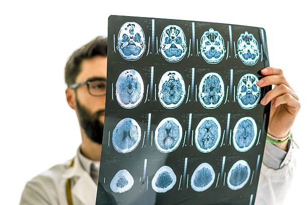 slip a vita bassa medico esaminando la radiografia del cervello - doctor brain x ray x ray image foto e immagini stock