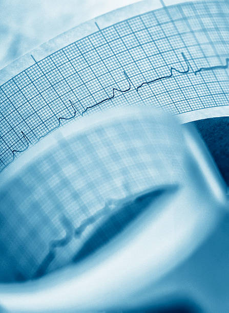 Printout of heart pulse trace.