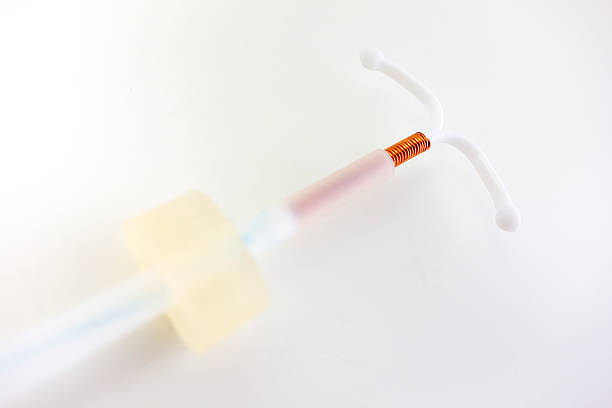 IUD insertion tube An intrauterine device (IUD) is a small plastic T-shaped device used for birth control. It is inserted into the uterus where it stays to prevent pregnancy. iud stock pictures, royalty-free photos & images