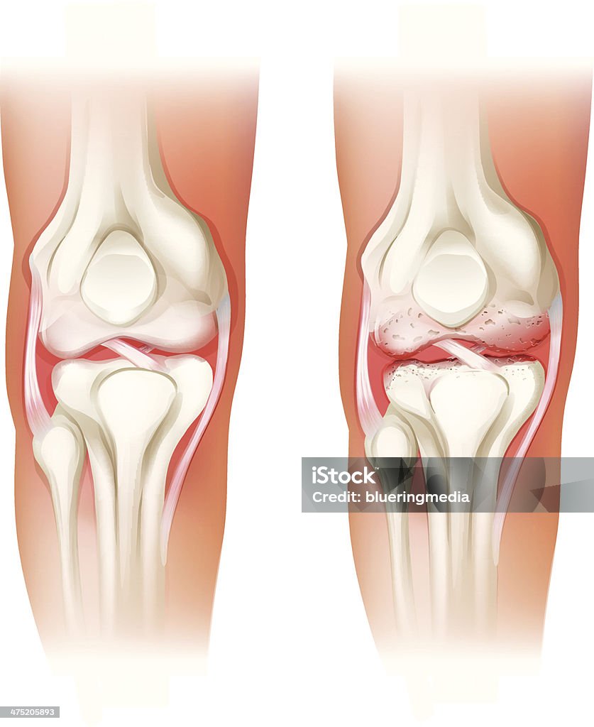 人間の膝関節 - 関節のロイヤリティフリーベクトルアート