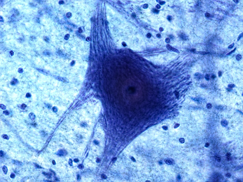 Microscopic image of a Motor Neuron and Glial Cells at 60x Magnification