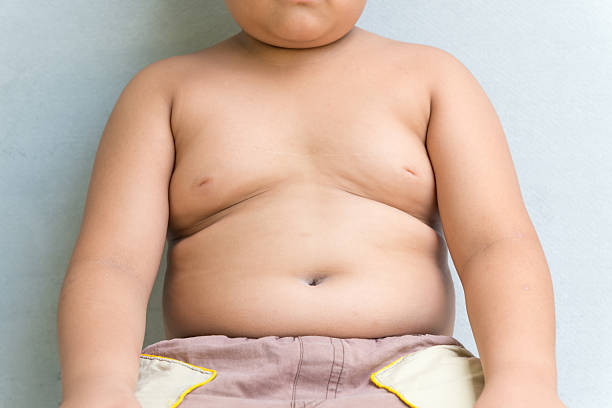 The size of stomach of children with overweight. The size of stomach of children with overweight. overweight child stock pictures, royalty-free photos & images