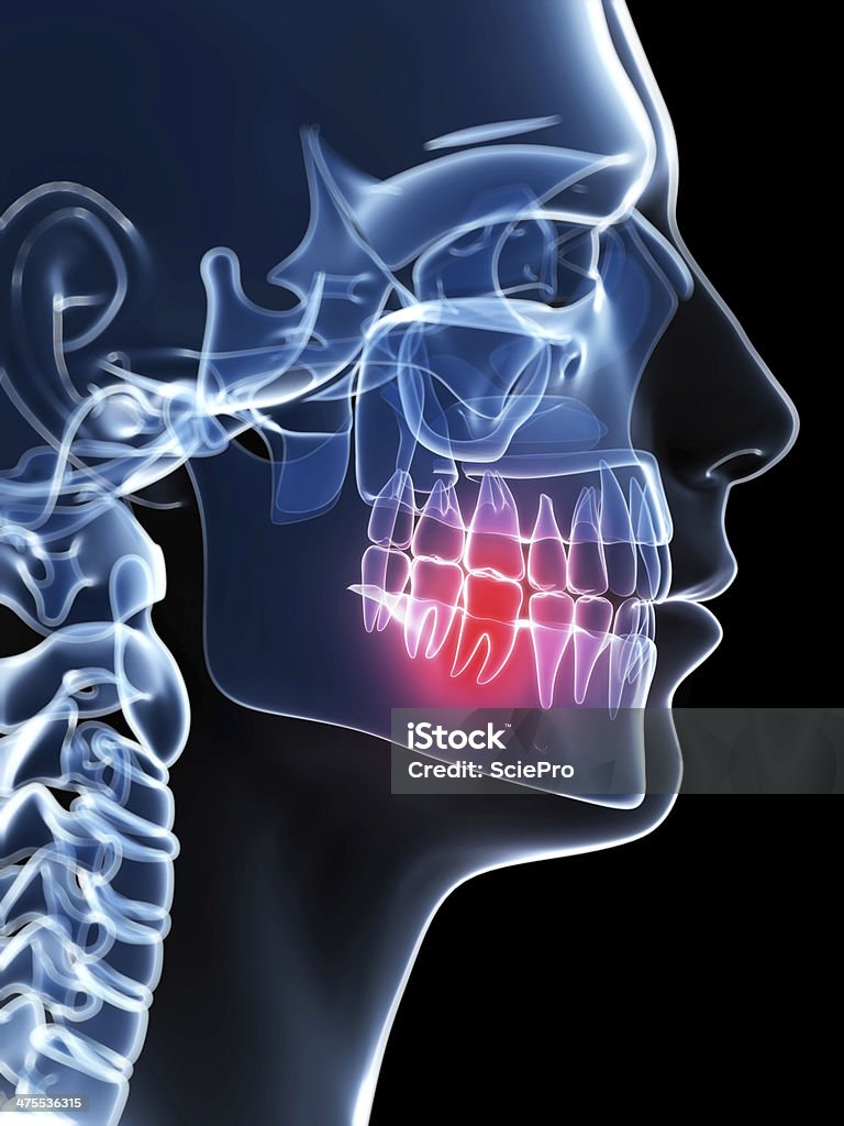 painful tooth 3d rendered illustration of a painful tooth Anatomy Stock Photo