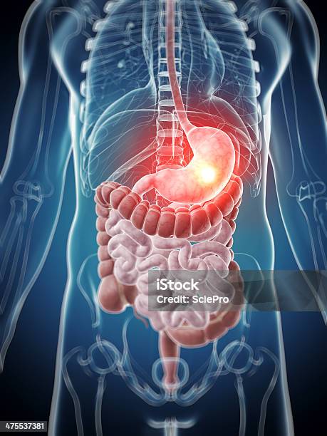 Rak Żołądka - zdjęcia stockowe i więcej obrazów Anatomia człowieka - Anatomia człowieka, Biologia - Nauka, Brzuch