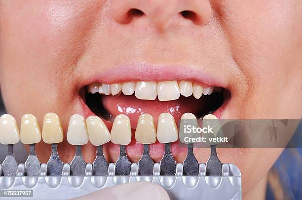 Shade Determination Tooth Stock Photo - Download Image Now - Adult, Anatomy, Body Care