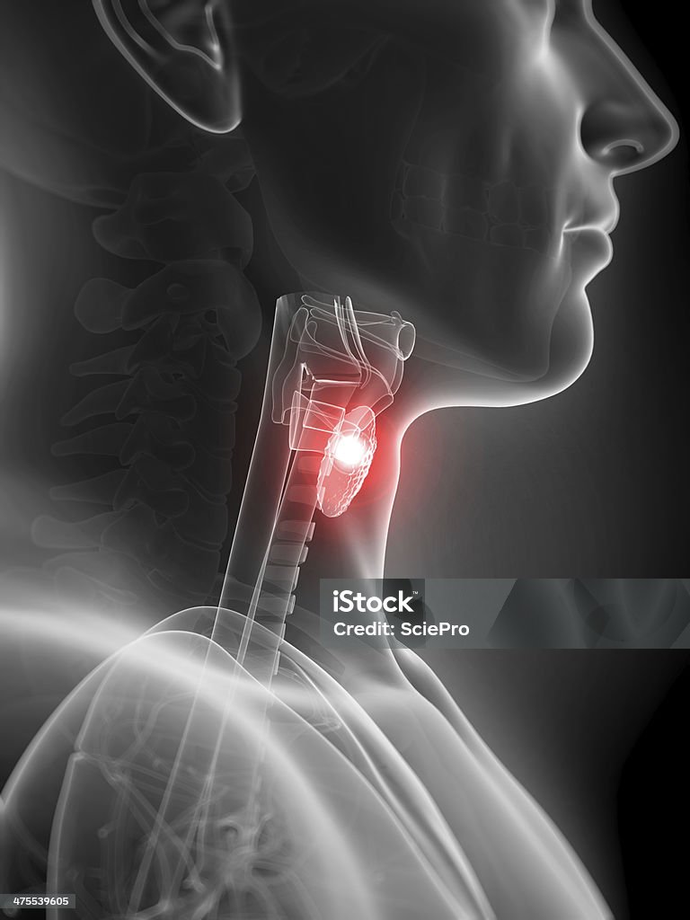 inflamed Glande thyroïde - Photo de Anatomie libre de droits