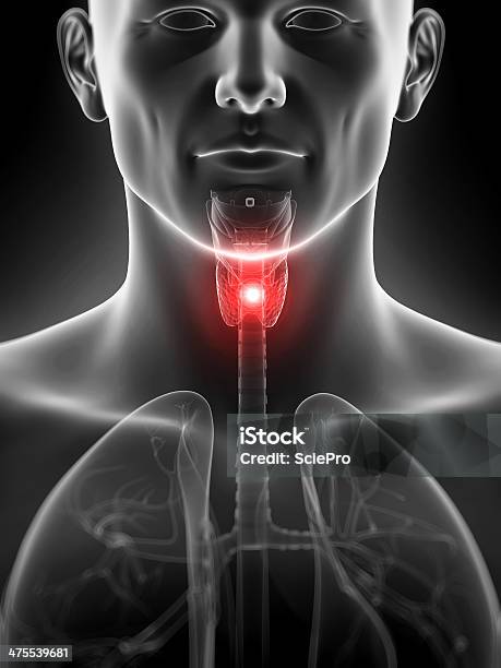 Inflamed Thyroid Gland Stock Photo - Download Image Now - Anatomy, Biology, Biomedical Illustration