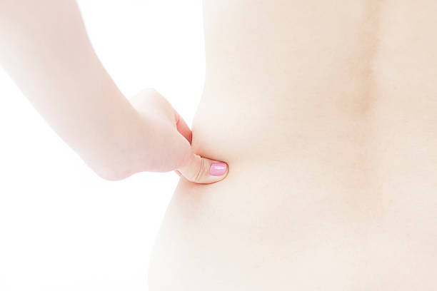 istock woman showing cellulite on her side 475565637