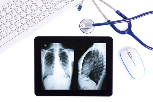 telehealth: 디지털 태블릿, 청진기, 흉부 x-선 격리됨에 - digital tablet doctor note pad x ray image 뉴스 사진 이미지