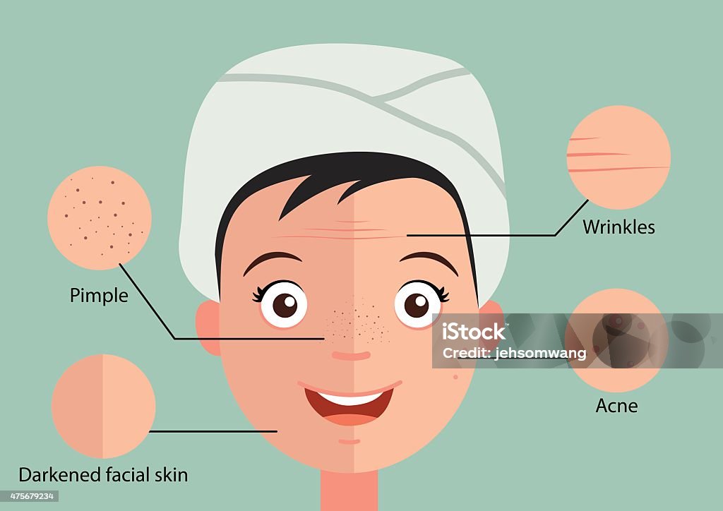 Skin Problems Animation Problem Skin Stock Illustration - Download Image Now - 2015, Acne ...