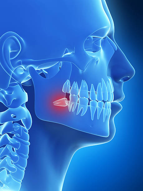 wisdom tooth 3d rendered illustration of the wisdom teeth wisdom-teeth stock pictures, royalty-free photos & images