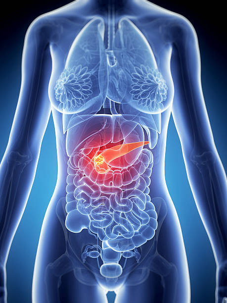 pancreas cancer stock photo