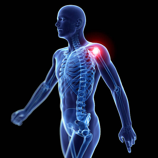 painful shoulder bursitis ripl fitness