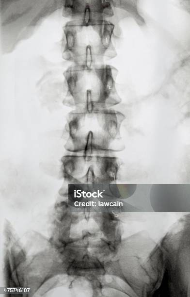 Spina Dorsale Umana - Fotografie stock e altre immagini di Anatomia umana - Anatomia umana, Bianco, Bianco e nero