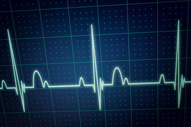 istock ECG / EKG monitor 475746638