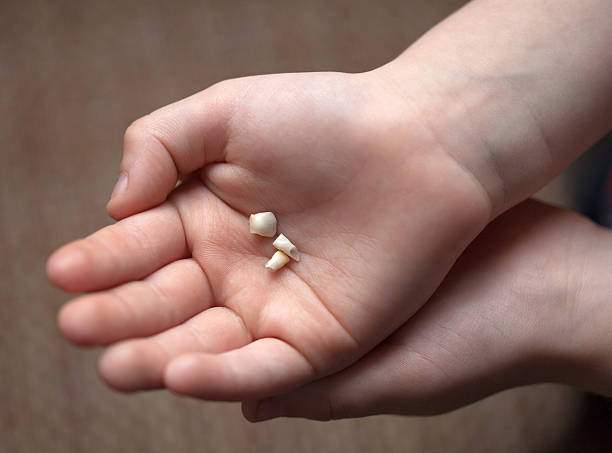 Milk tooth on the palm stock photo