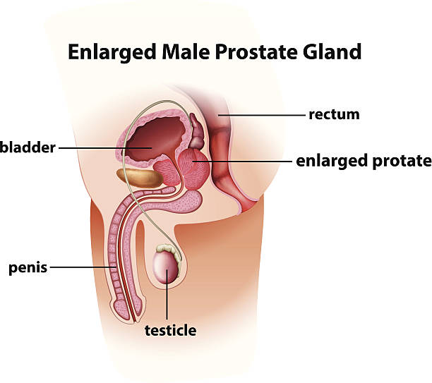 Enlarged male prostate gland Enlarged male prostate gland on a white background phallic object stock illustrations