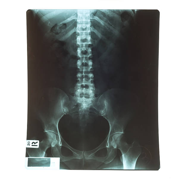 istock X-Ray image of human for a medical diagnosis 475898252