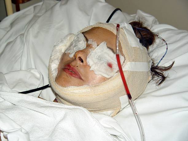 cirurgia plástica de rosto feminino adulto - emergency room flash - fotografias e filmes do acervo