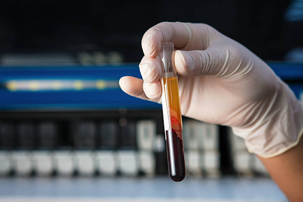 Tubo de sangue em Microbiologia laboratório - fotografia de stock