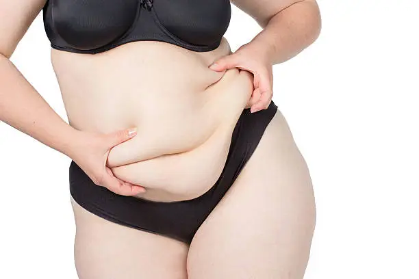 Obese neglected body isolated over white background.