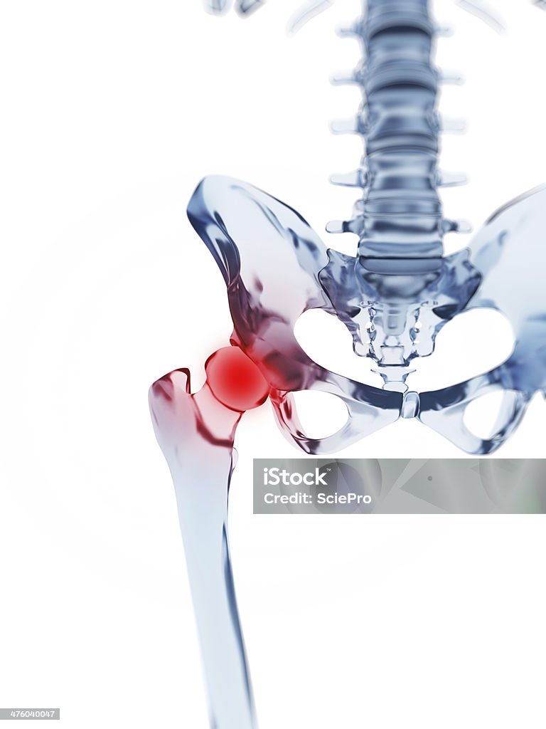 Болезненные тазобедренного сустава - Стоковые фото Таз роялти-фри