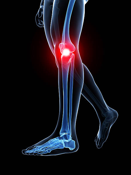 painful knee 3d rendered medical illustration - painful knee knee photos stock pictures, royalty-free photos & images
