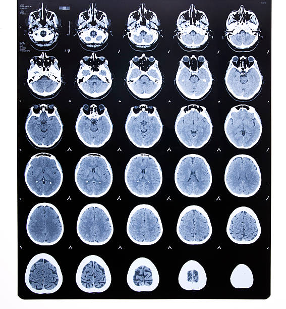 x-ray - mri scan cat scan machine x ray brain foto e immagini stock