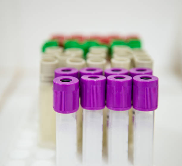 istock Blood tube for testing in laboratory. 476248320