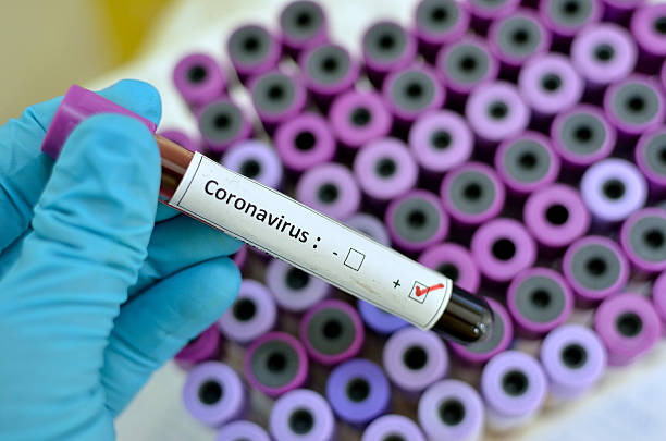 coronavirus positivo - non moving activity foto e immagini stock