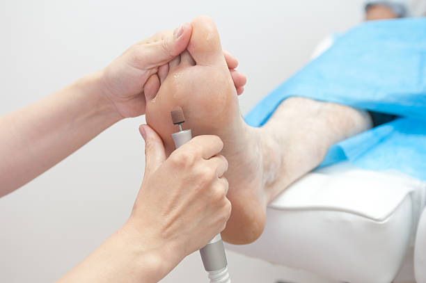 große verfahren - podiatry chiropody toenail human foot stock-fotos und bilder