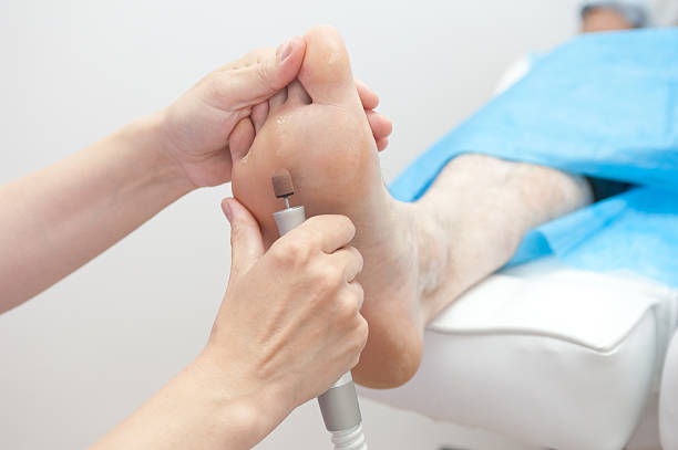 procedura stopy - podiatry chiropody toenail human foot zdjęcia i obrazy z banku zdjęć