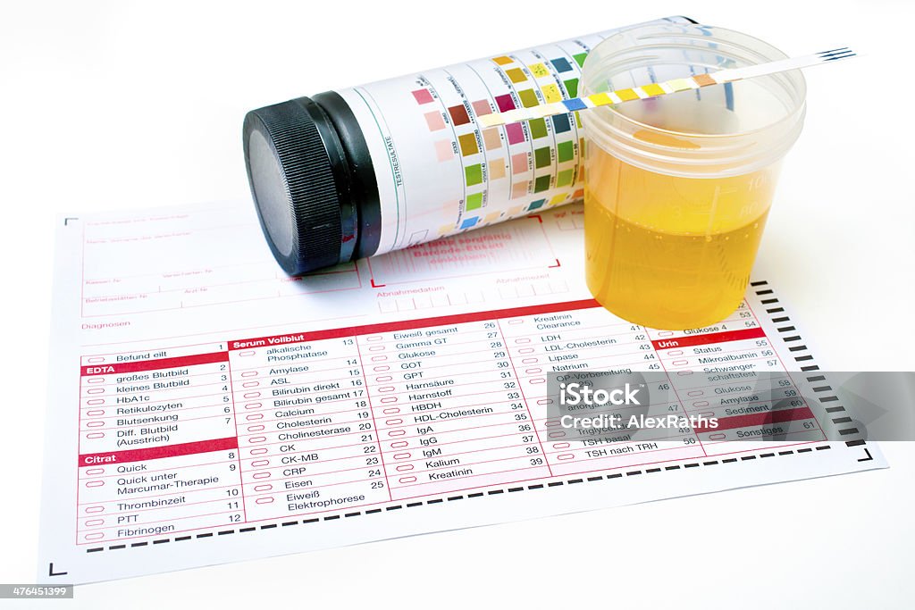 Urine test strips Medical exam, Hands with  the urine test strip Bacterium Stock Photo