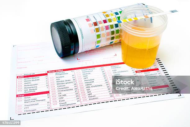 Urine Test Strips Stock Photo - Download Image Now - Bacterium, Blue, Bottle