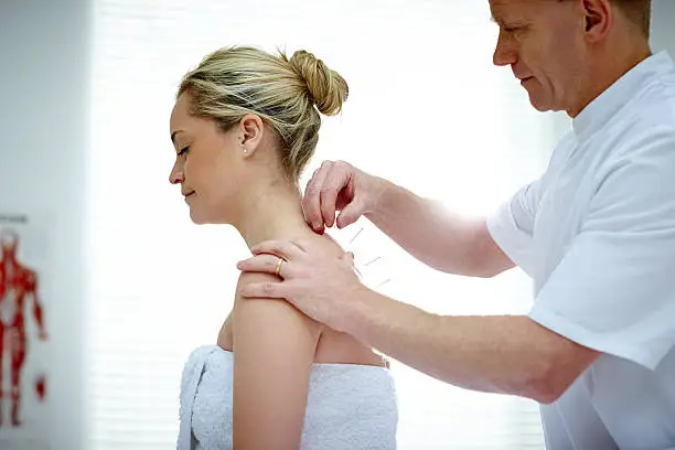 Physiotherapist doing acupuncture on the back of a female patient sitting on medical room