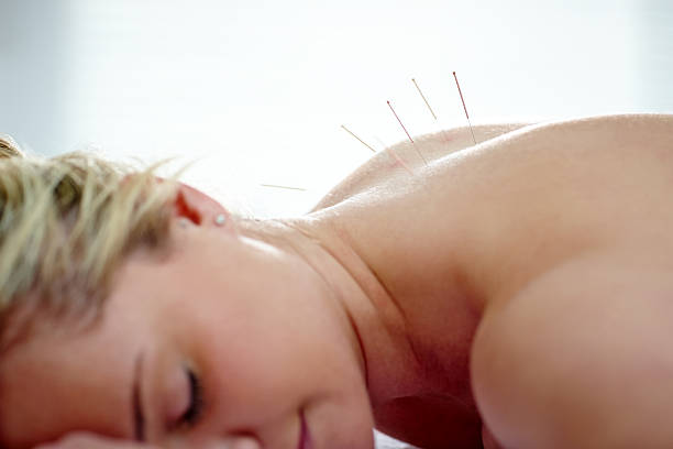 Acupuncture treatment--Traditional Chinese medicine series.