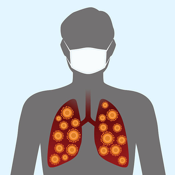 ilustrações, clipart, desenhos animados e ícones de vírus e máscara facial, ilustração de imagem - sudden acute respiratory syndrome human lung acute angle virus