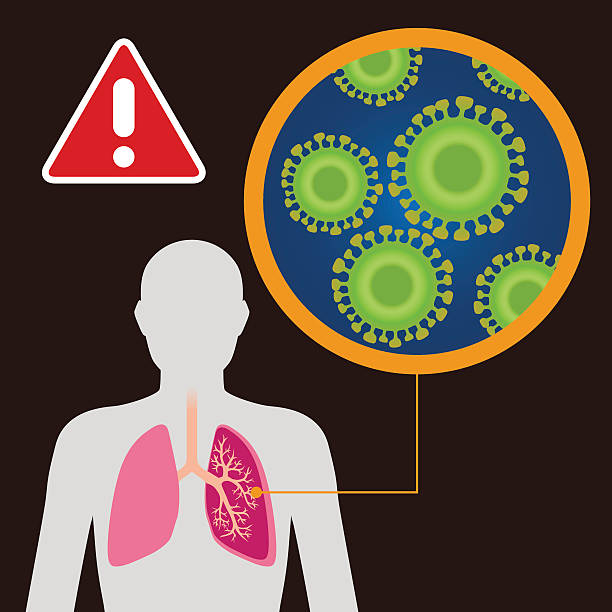 ilustrações, clipart, desenhos animados e ícones de vírus e contaminação ilustração de imagem - sudden acute respiratory syndrome human lung acute angle virus