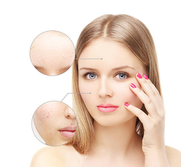 istock Girl with problem and clear skin. 476892900