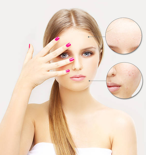 istock Girl with problem and clear skin. 476892928
