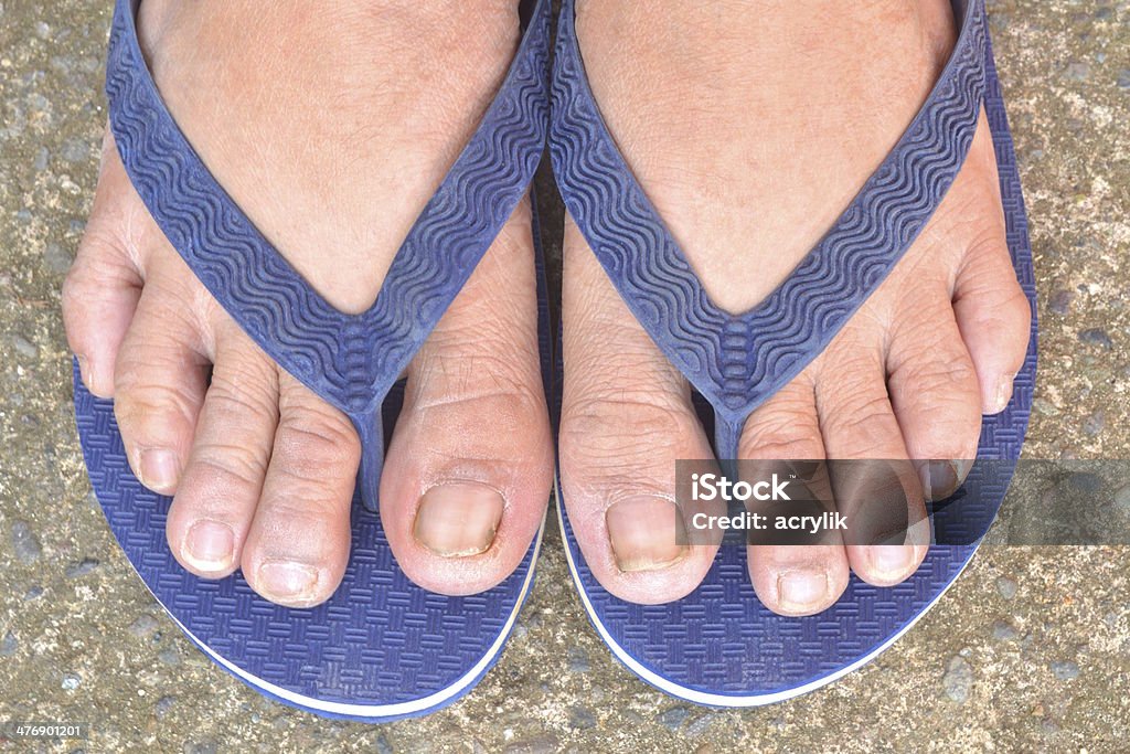 Com miúdos de unhas dos pés quadrados - Foto de stock de Anti-higiênico royalty-free